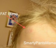 Second Child Bump